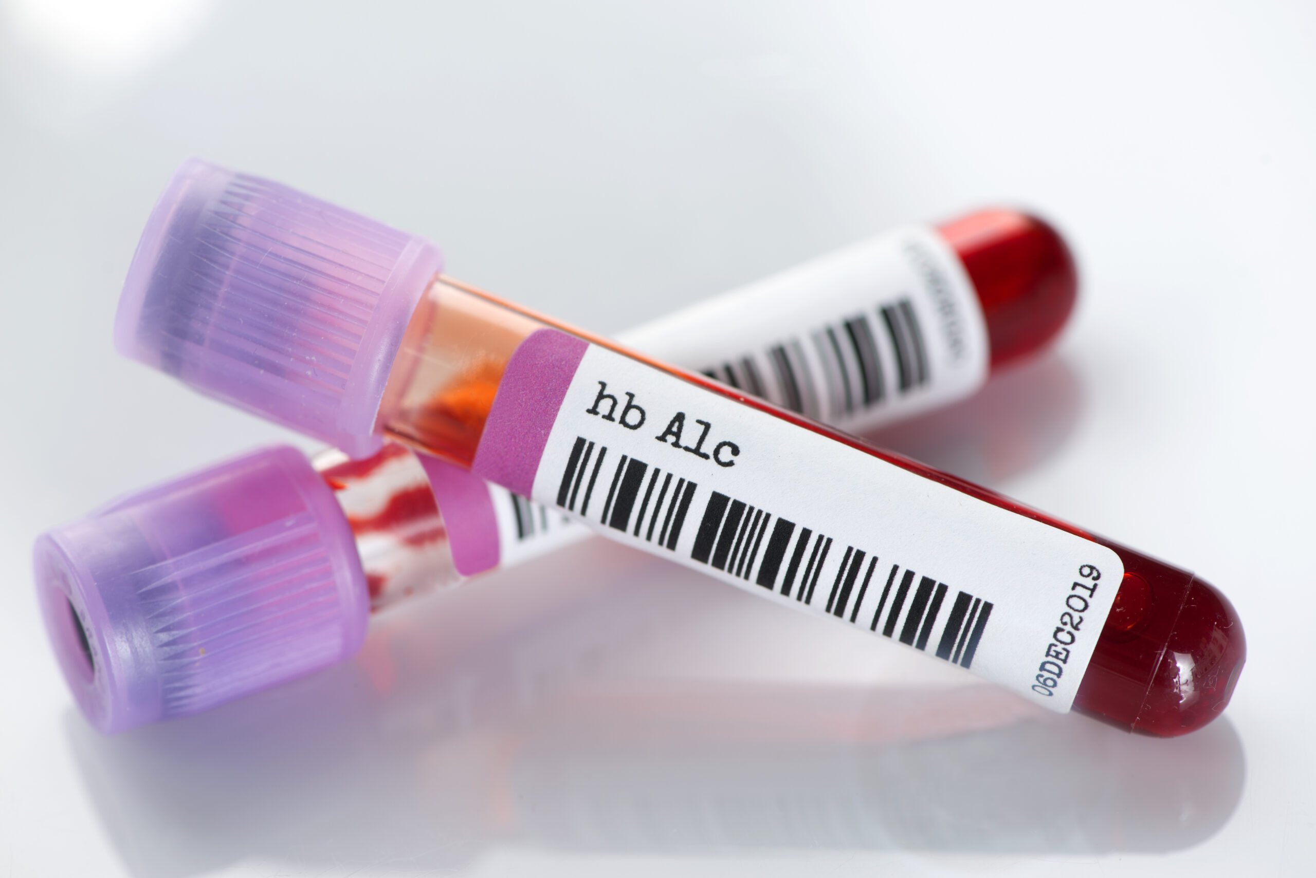 Metformin & Your A1c Levels