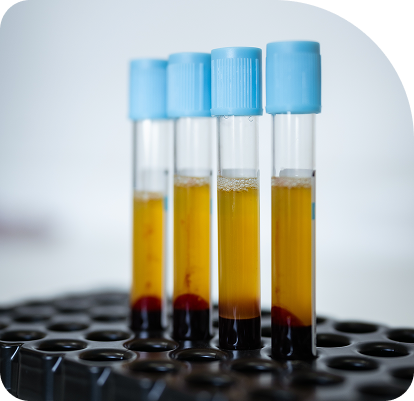 vials of blood in lab