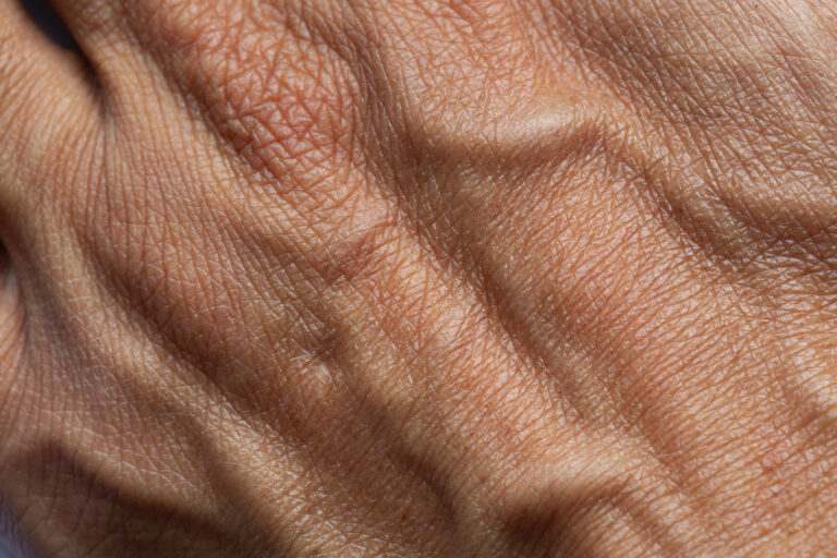 Biological age